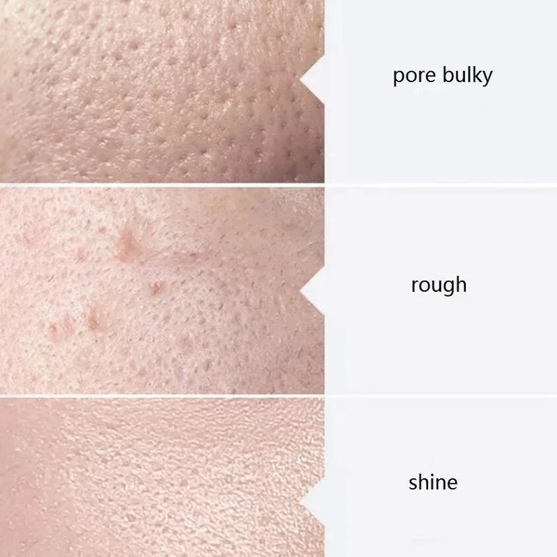 Yatava's Aqua Peel Solution Kit